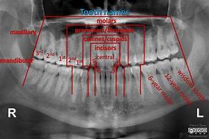 Tooth Notation Permanent Radiology Case Radiopaedia Org