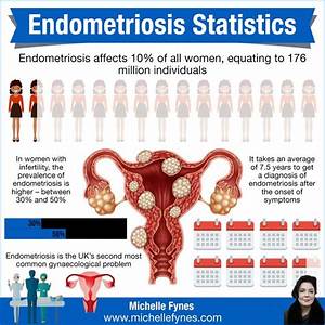 Endometriosis Statistics Endometriosis Obstetrician Gynecology