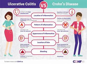 Ulcerative Colitis And Crohn 39 S Disease What 39 S The Difference