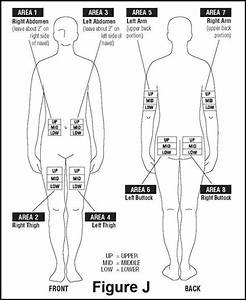 Diagram Of Injection Sites