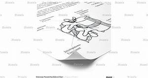 Sclerotome Visceral Referral Chart Poster