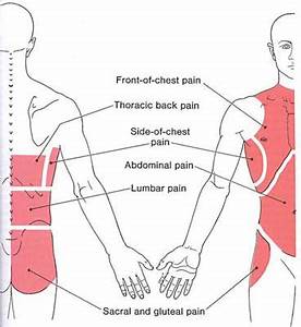 The Trigger Point Referred Guide