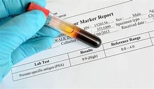 What Psa Level Indicates Cancer Moffitt