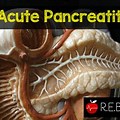 Hemorrhagic Pancreatitis
