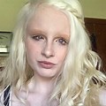 Albino with Blonde Hair Violet Eyes