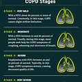 COPD Life Expectancy Chart
