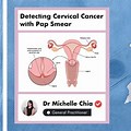 Cervical Cancer Scree… 
