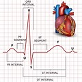 Electrocardio… 