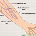 Phlebotomy Arm