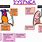 Types of Dyspnea