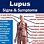 All Lupus Symptoms