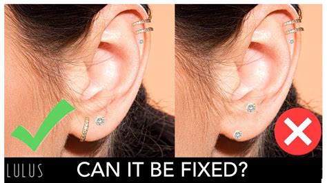 Non-surgical fixes for uneven pierced ears