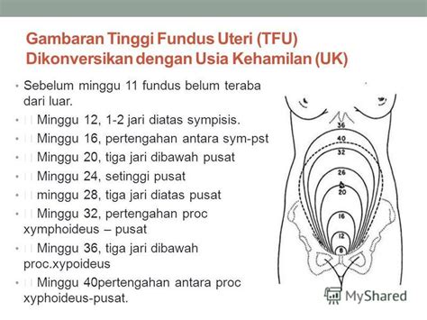TFU ibu hamil di Indonesia