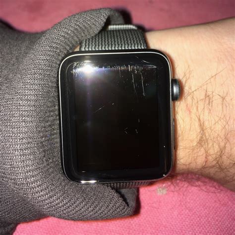 apple watch scratches