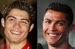 ANTES E DEPOIS DO SORRISO DOS FAMOSOS | Homens que se Cuidam