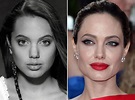 Angelina Jolie, Before and After | Angelina jolie nose, Angelina jolie ...