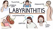 Understanding Labyrinthitis - YouTube
