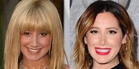 Ashley Tisdale's Nose Job: Face Before and After Surgery