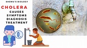 Vibrio cholera causes, symptoms, prevention and diagnosis - YouTube