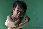 Agent Orange Victims Then And Now, In 24 Disturbing Photos