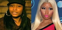 Nicki Minaj Nose Job Plastic Surgery Before And After Photos