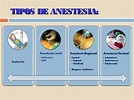 Introducción a la anestesia: Tipos de anestesia