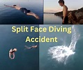 Split Face Diving Accident | Split Face Diving Accident Full Video
