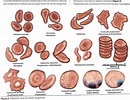 hematopoyesis: fisiologia del eritrocito. anemia: conceptos basicos ...