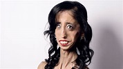 How Being Called The 'World's Ugliest Woman' Transformed Her Life ...