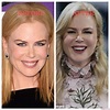 Nicole Kidman Plastic Surgery Photos [Before & After] - Surgery4