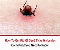 How To Get Rid Of Seed Ticks Naturally - Getridofallthings.com