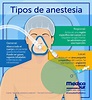 Tipos De Anestesia Y Sus Cuidados De Enfermeria - ajore