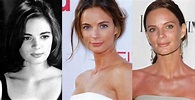 Gabrielle Anwar Plastic Surgery Before and After Pictures 2024
