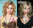 Aly Michalka Before and After Breast Implants?