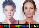 Gabrielle Anwar Plastic Surgery Before and After | Plastic Surgery Magazine