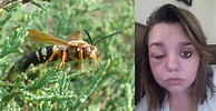 Carrollton Resident Allegedly Stung by Cicada Killer Wasp