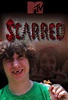 Scarred | TV Time
