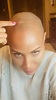 Jada Pinkett Smith shares update on hair loss due to alopecia