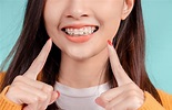 傳統vs隱形牙箍邊樣好？傳統現代箍牙技術大比拼 - she.com