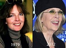 Diane Keaton Plastic Surgery Before and After - CELEB-SURGERY.COM
