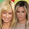 Ashley Tisdale Before and After Her Nose Job Plastic Surgery Photos