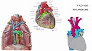 Grandes Vasos del Tórax - Anatomía del Tronco Pulmonar - YouTube