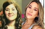 Antes y después de las cirugías, las fotos de famosas argentinas