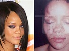 Investigan a policías por filtrar foto de Rihanna golpeada | Actualidad ...
