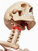 Human Axis Bone Photograph by Sebastian Kaulitzki/science Photo Library