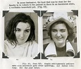 15 Lobotomy Patients Before And After Their Procedure