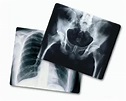 X Ray Film, For Medical Purpose at Rs 1980/box in Purnia | ID: 7920930897