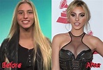 Lele Pons Nose Job: Lele's Path from Youtube To beauty Queen