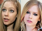 Avril Lavigne Before After Plastic Surgery