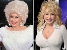 26 Over-The-Top Hollywood Plastic Surgeries | V103 | Dolly parton ...